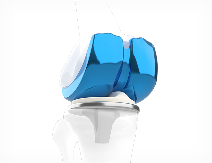 Chrome