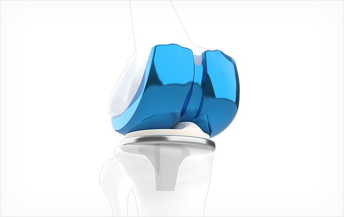Chrome