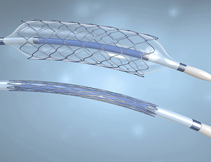 Stent