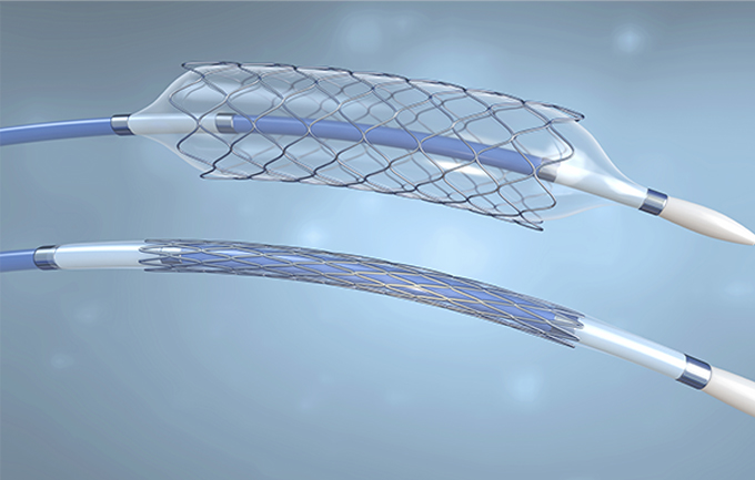 Stent