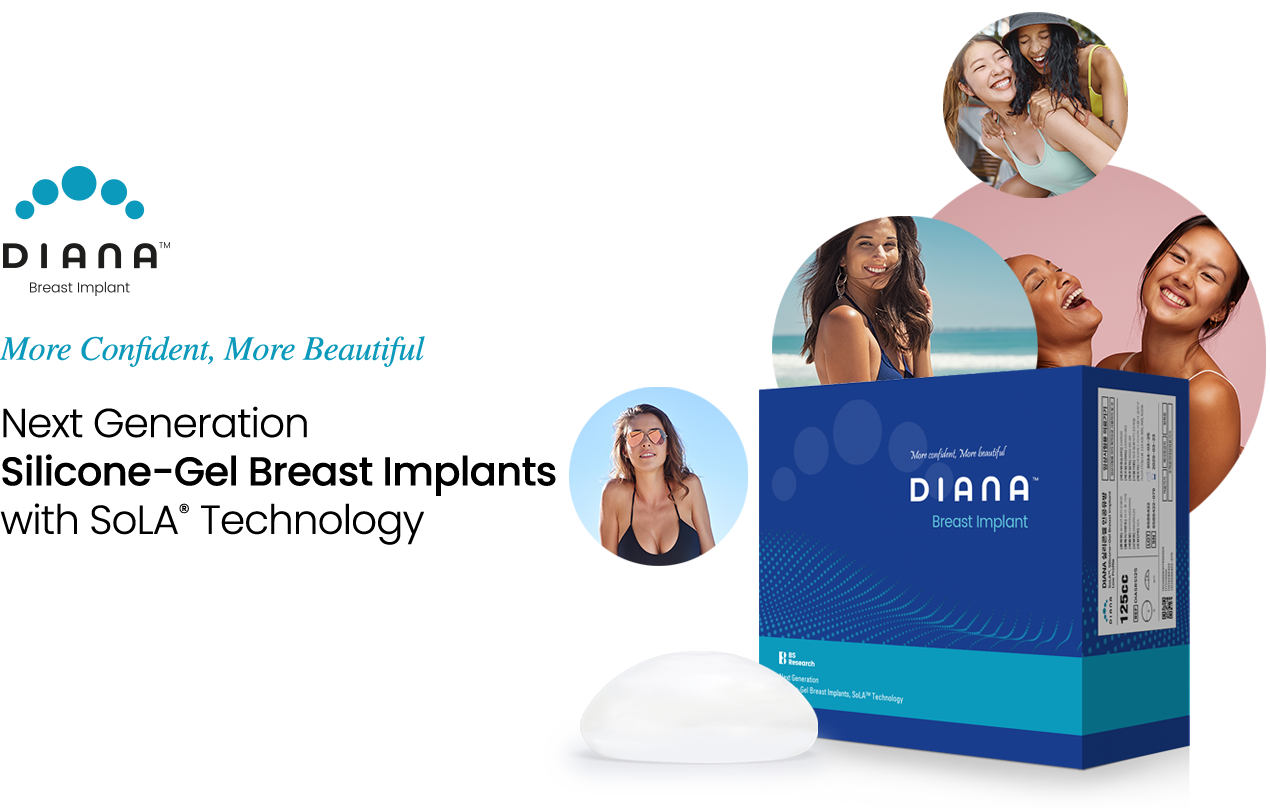 DIANA
